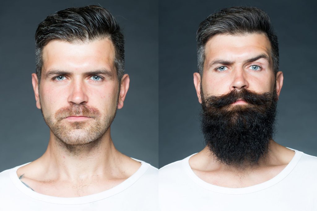 Baard groeien
